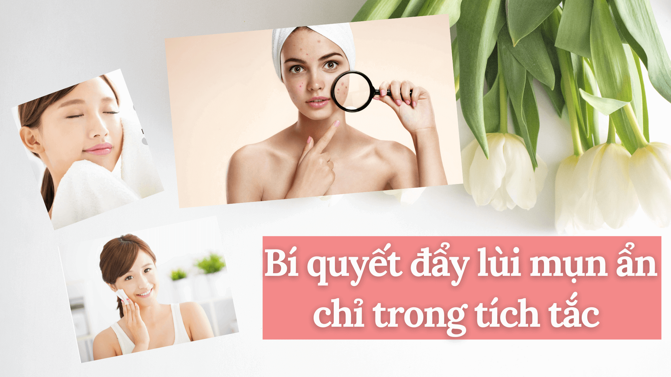 Bí quyết đẩy lùi mụn ẩn chỉ trong tích tắc, tham khảo ngay để sở hữu làn da vạn người mê