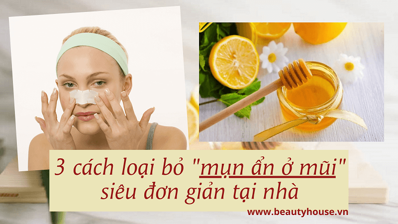 Mụn ẩn ở mũi làm sao để đẩy lùi? Bí quyết chỉ đơn giản với 3 cách tại nhà