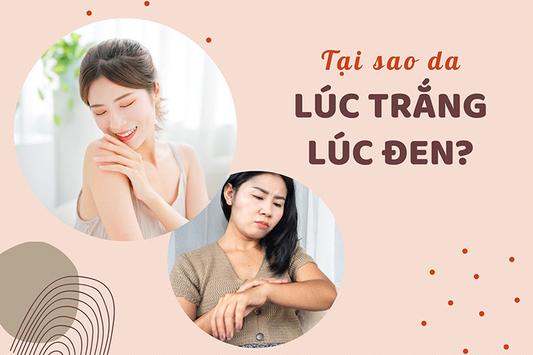 Bạn có biết: Tại sao da lúc trắng lúc đen?